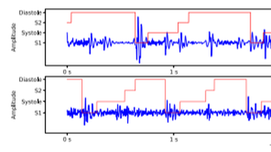 Heart sound segmentation via Duration Long–Short Term Memory neural network.